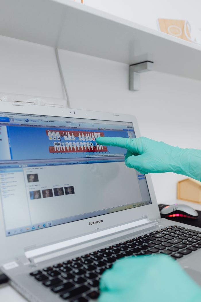 Gloved hand pointing at dental chart on a Lenovo laptop screen in a clinical setting.